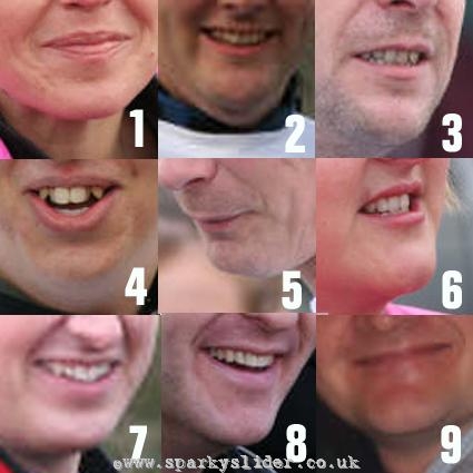 Chin Quiz2